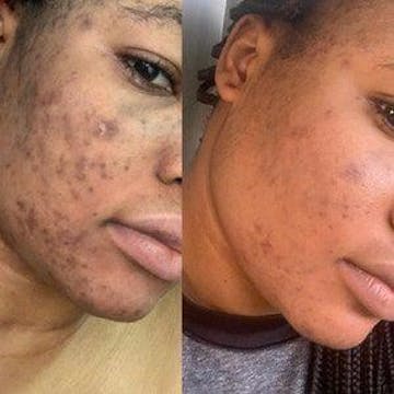 NovaGlow | Peau Neuve, Glow Intense