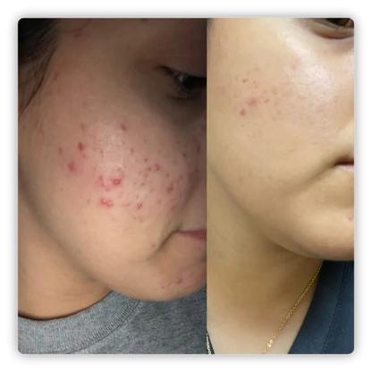 NovaGlow | Peau Neuve, Glow Intense