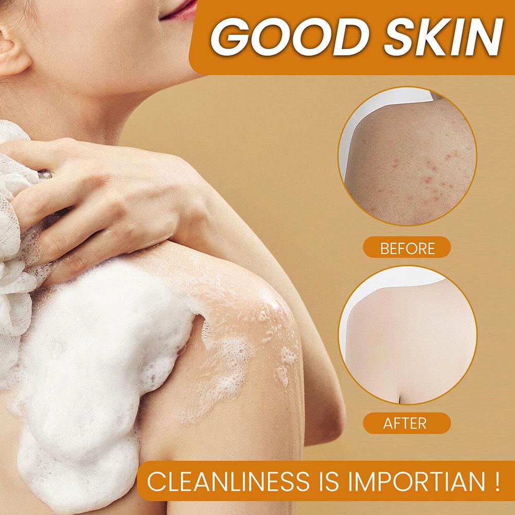 Savon fait à la main au curcuma, savon à l'acide kojique au citron, savon de douche et pour le visage, nettoyage en profondeur pour les soins de la peau du visage et du corps, 100g