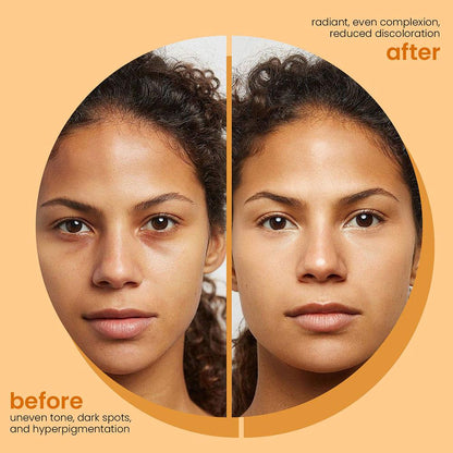 Savon fait à la main au curcuma, savon à l'acide kojique au citron, savon de douche et pour le visage, nettoyage en profondeur pour les soins de la peau du visage et du corps, 100g