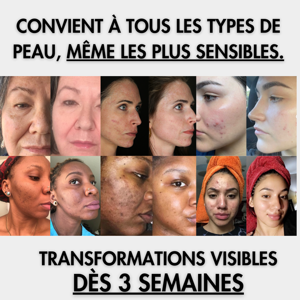 NovaGlow | Peau Neuve, Glow Intense