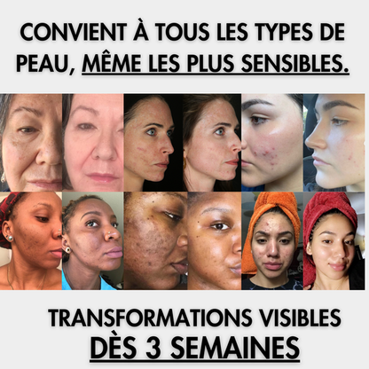 NovaGlow | Peau Neuve, Glow Intense