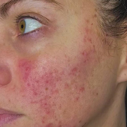 NovaGlow | Peau Neuve, Glow Intense